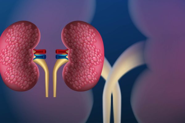 kidney disease, Human anatomy care. kidney cancer. realistic ve kidney disease, Human anatomy care. kidney cancer. realistic vector illustration isolated on blue background
