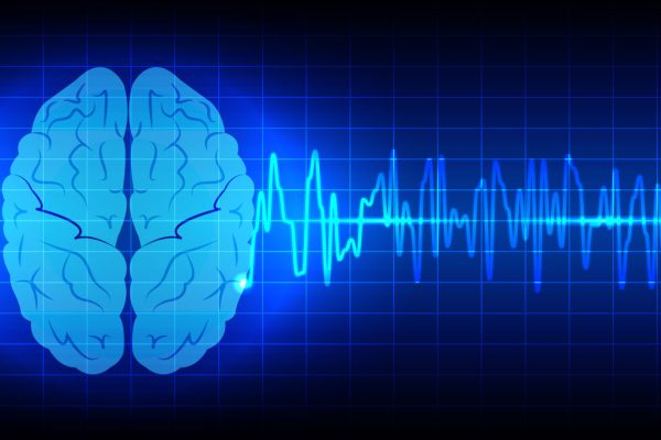 functional-neurology functional-neurology